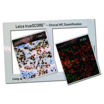 Side By Side Magnetic Photo Frame (95 X 145 X 0.5 Mm)